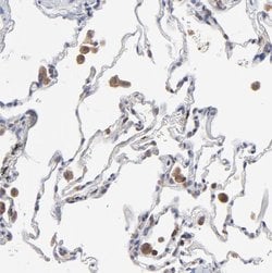 MOSPD2 Antibody, Novus Biologicals 25 &mu;L, Unlabeled:Antibodies, Polyclonal